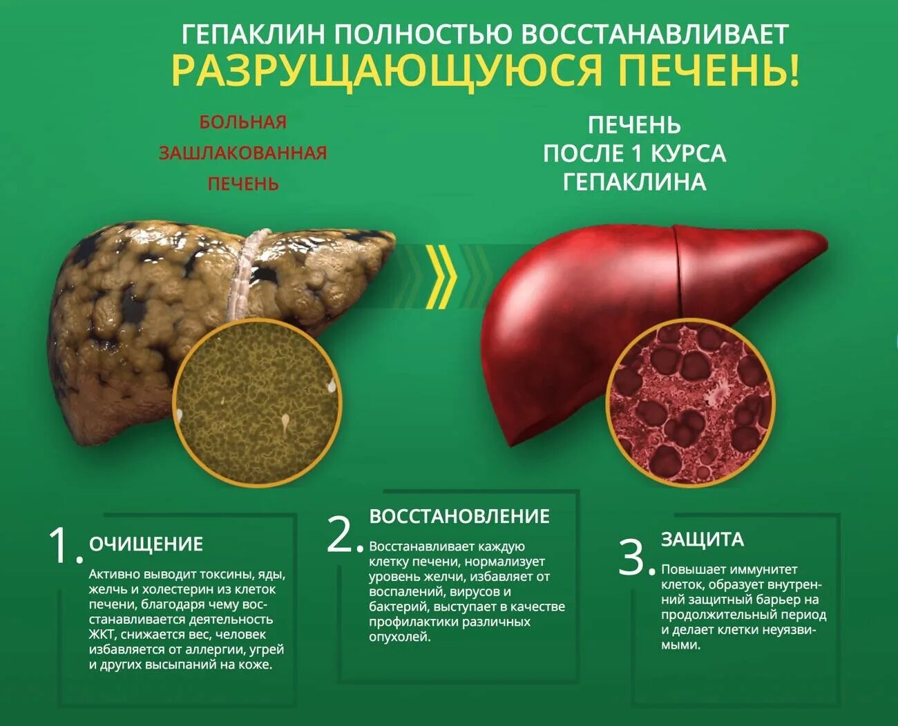 Какие лекарства принимать при гепатозе печени. Восстановление печени. восстановление клеток печени. восстанавливает клетки печени. восстановление функции печени.
