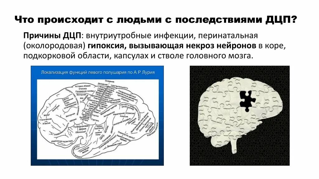 Дцп мозг. Нарушение мозга при ДЦП. Изменения в головном мозге при ДЦП.