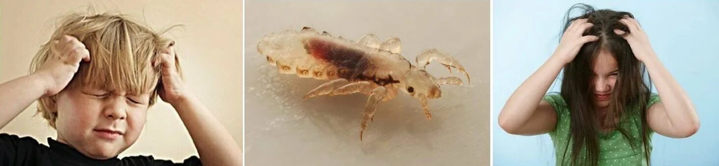 Головная вошь возбудитель. Педикулез возбудитель. Вши головная платяная лобковая. Пути передачи и факторы передачи педикулеза. Передача вшей.