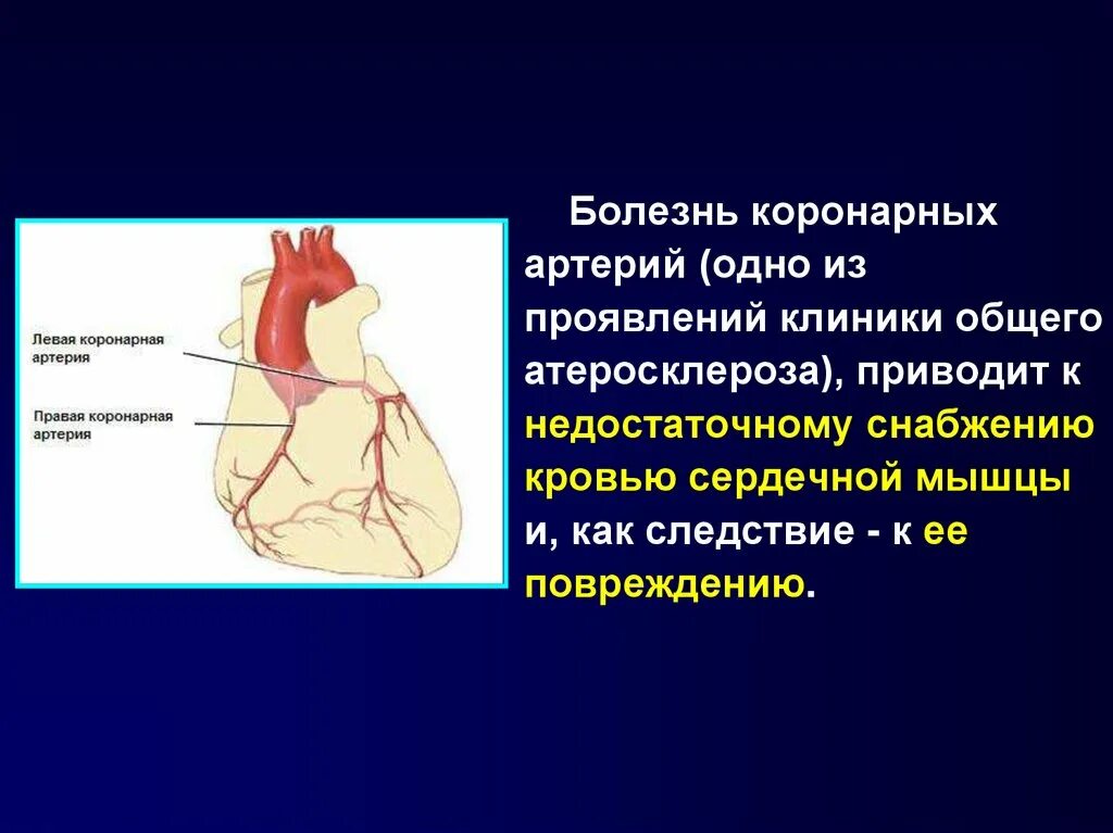 Расширяет коронарные сосуды. Коронарные артерии. Болезнь коронарных артерий. Спазм коронарных артерий. Устье коронарных артерий.