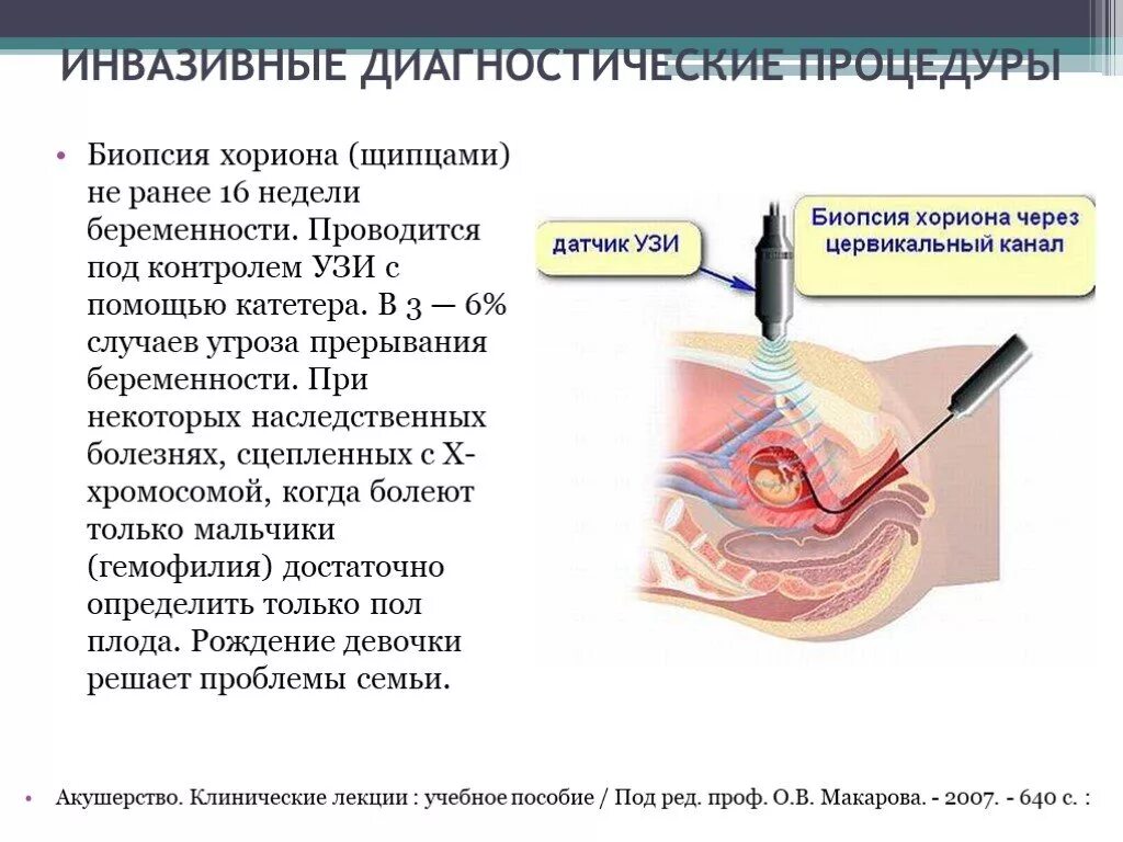 Что такое биопсия хориона при беременности. Пренатальная диагностика биопсия хориона. Инвазивные методы пренатальной диагностики биопсия. Биопсия ворсин хориона показания. Инвазивный тест при беременности