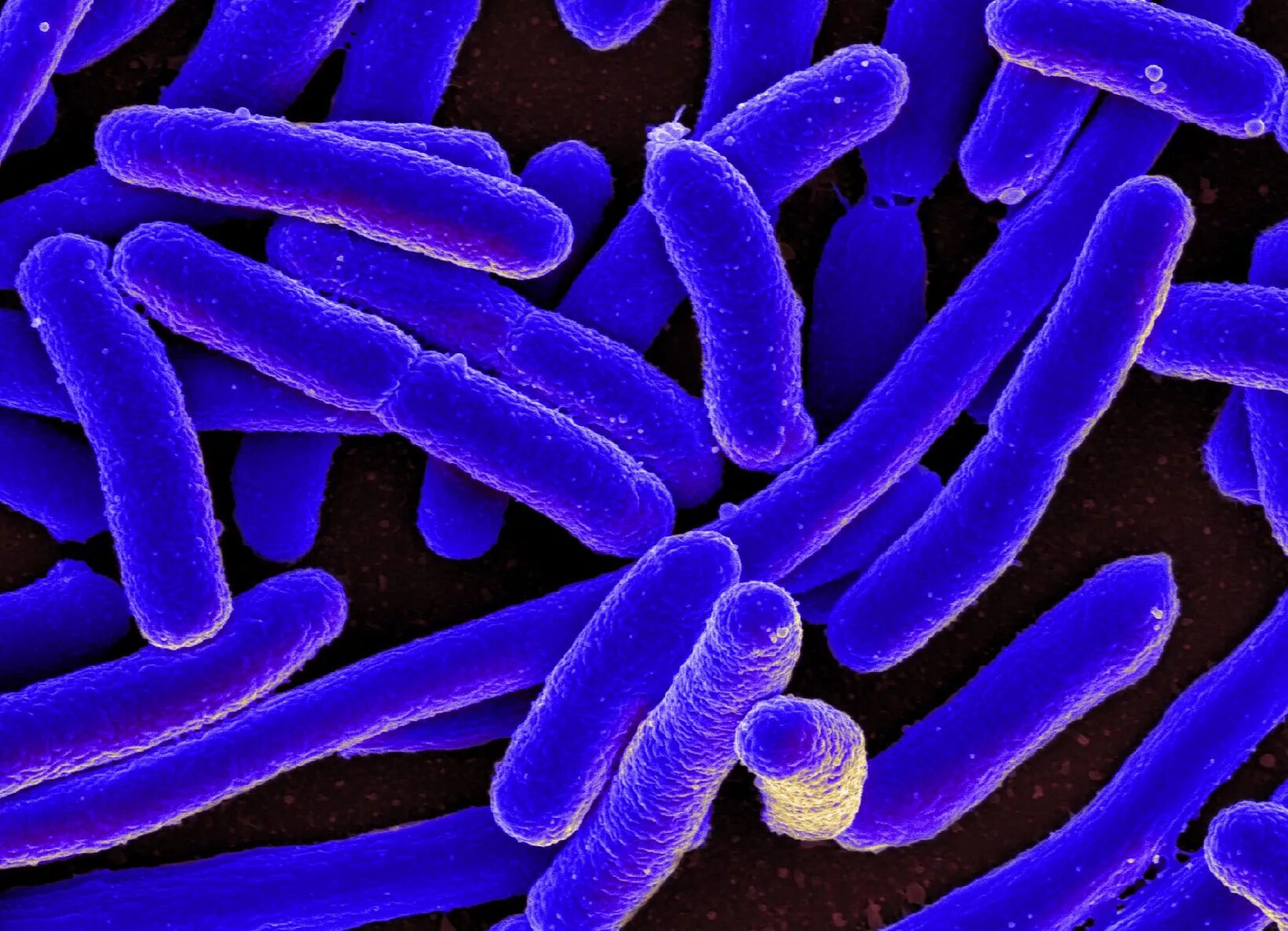 Бактерия Escherichia coli. Кишечная палочка Escherichia coli. Бактерия Escherichia coli под микроскопом. О микроорганизмы Escherichia coli. Микробиологические на аэробные микроорганизмы