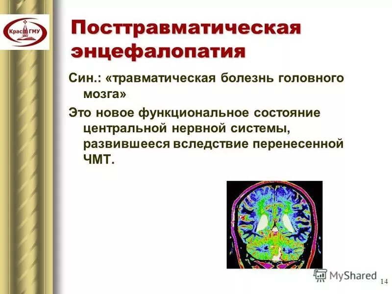 Травматическая болезнь мозга. Посттравматическая энцефалопатия. Травматическая энцефалопатия мозга. Энцефалопатия головного мозга что это такое. Посттравматическая энцефалопатия с цефалгиями.