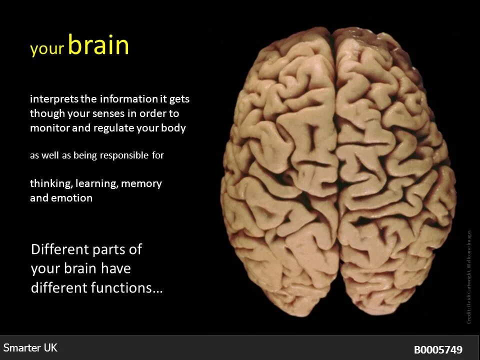 Brain scientist. Полушария мозга. Мозг человека полушария. Мозг человека два полушария. Гемисфера мозга что это.