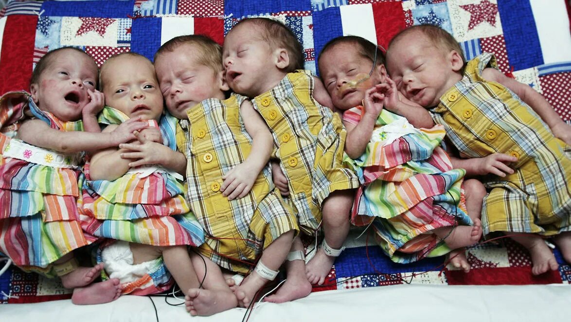 Сколько женщина может родить за раз детей. Шестеро детей. Рекорд по количеству близнецов. Самое большое Кол во близнецов.