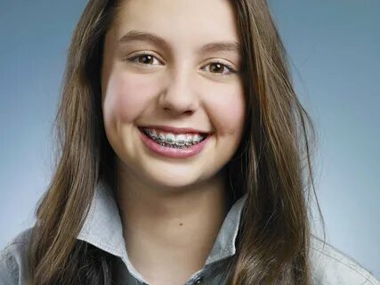 Timing is Everything In Orthodontics When Treating Children Braces.
