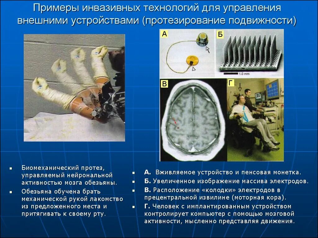 Инвазивные виды. Примеры изващийных видов. Примеры извазийных видов. Биомеханические устройства и протезы контролируемые усилием мысли