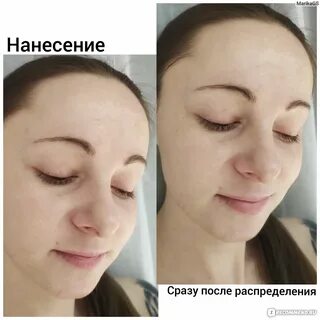 Пилинг с аскорбиновой