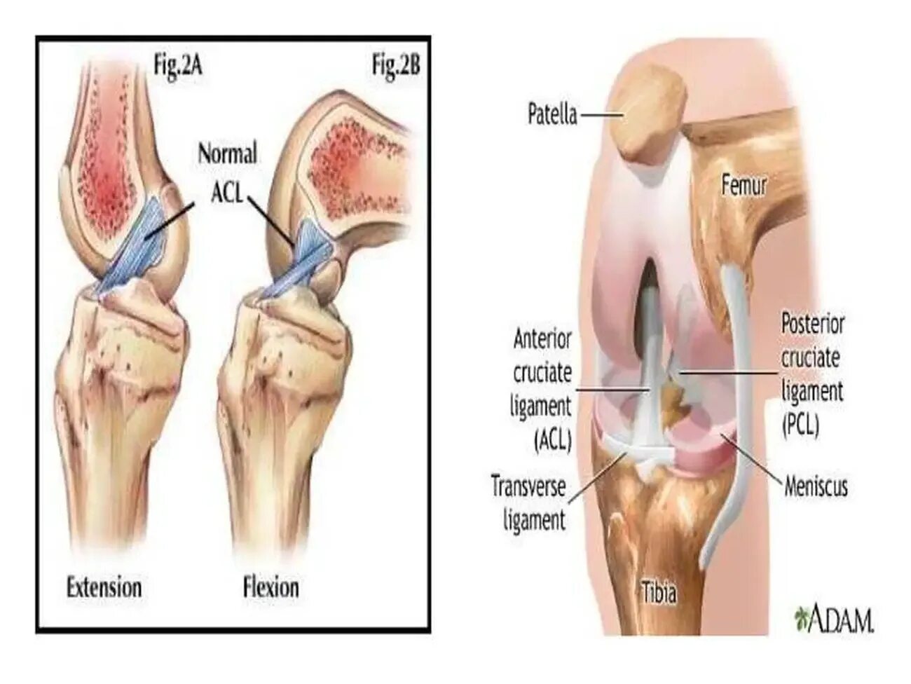 Acl что это. Anterior ligaments of Knee.