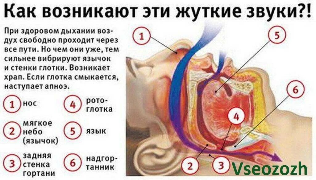 Сильный храп во сне. Почему люди храпят во сне. причины храпа у мужчин.
