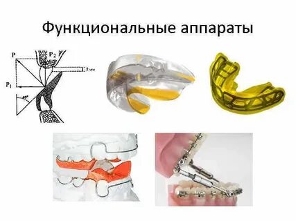 Функциональный прибор