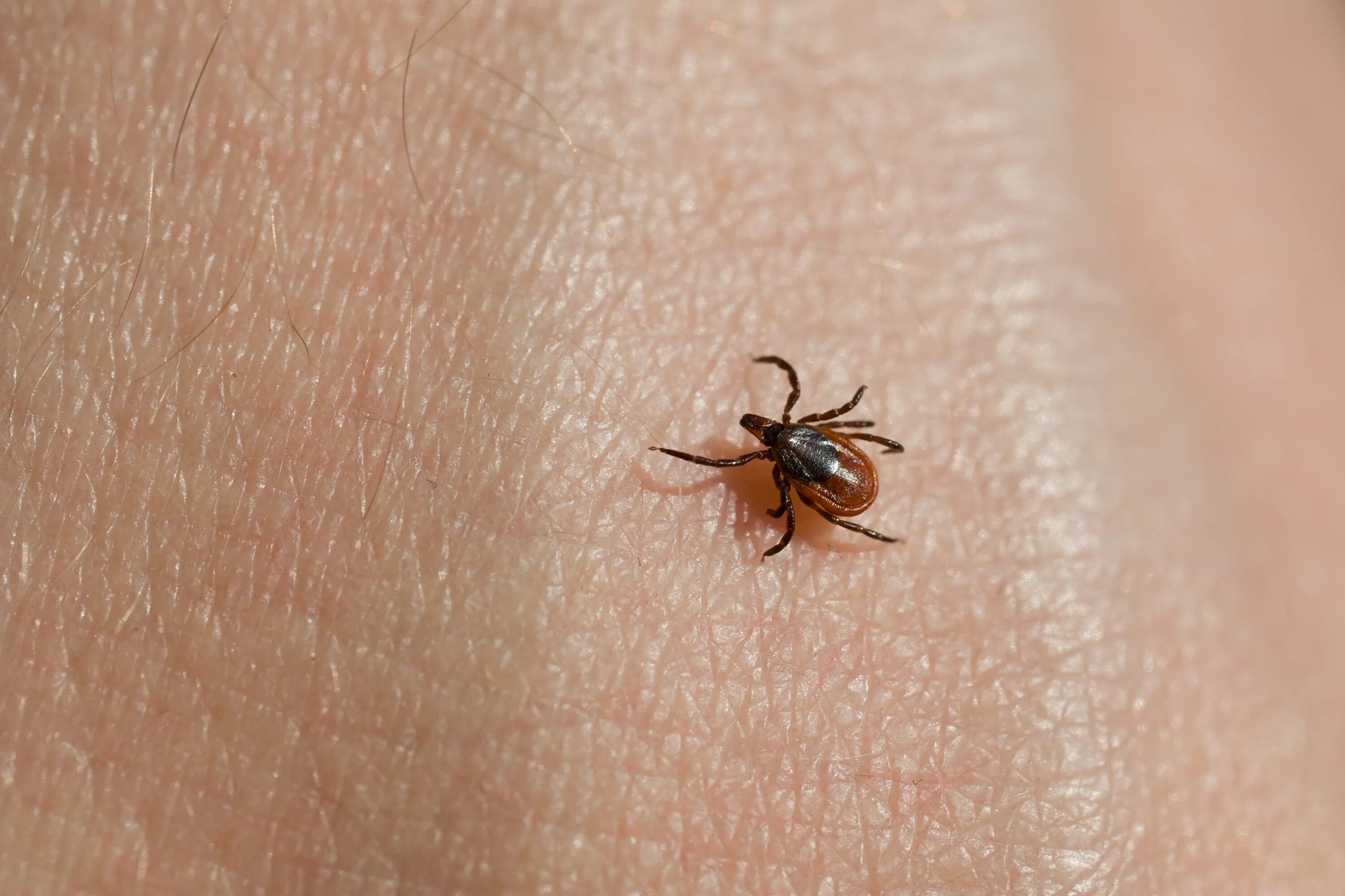 Как вылечить клещ в домашними. Ixodes scapularis. клещ сибирский энцефалитный. иксодовые клещи.