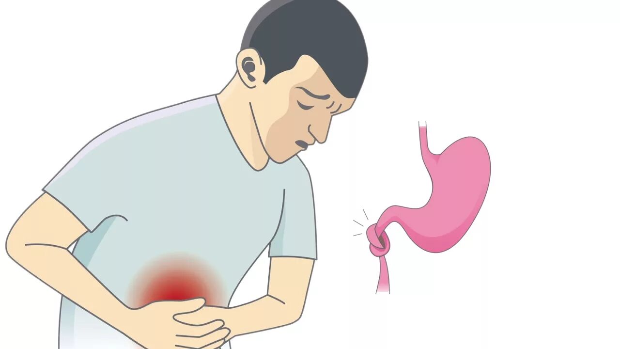 Схваткообразные боли в животе в области. Боль в животе картинка. Человек с больным животом. Пациент с болью в животе.