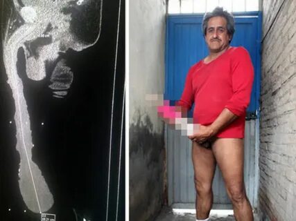 Biggest Panis Fuck - Man with world's longest 18.9in penis tries to ha...