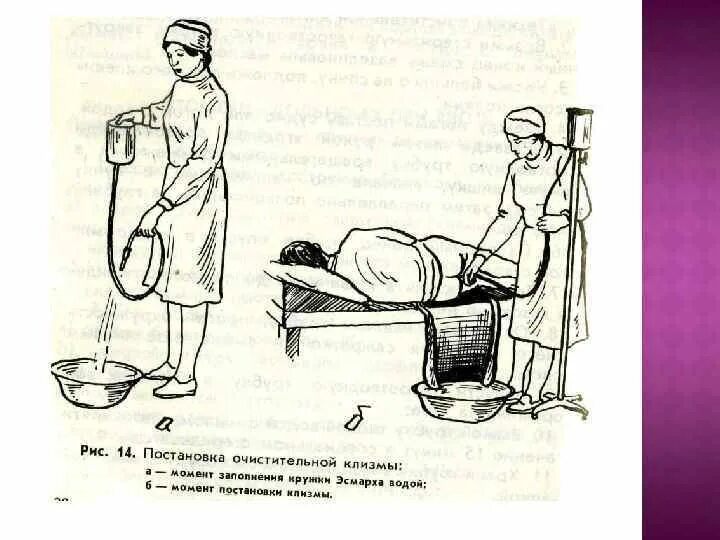 Очистительная клизма алгоритм выполнения