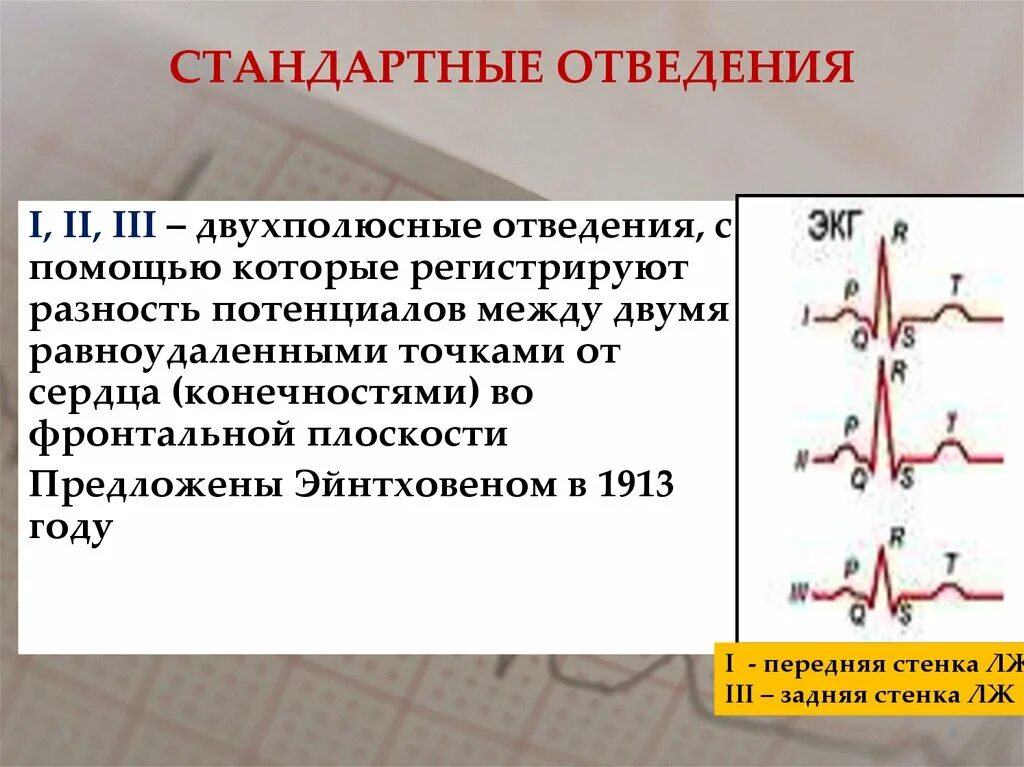 1 Стандартное отведение ЭКГ. Стандартные отведения ЭКГ. ЭКГ во 2 стандартном отведении. Стандартные двухполюсные отведения. Правые грудные отведения