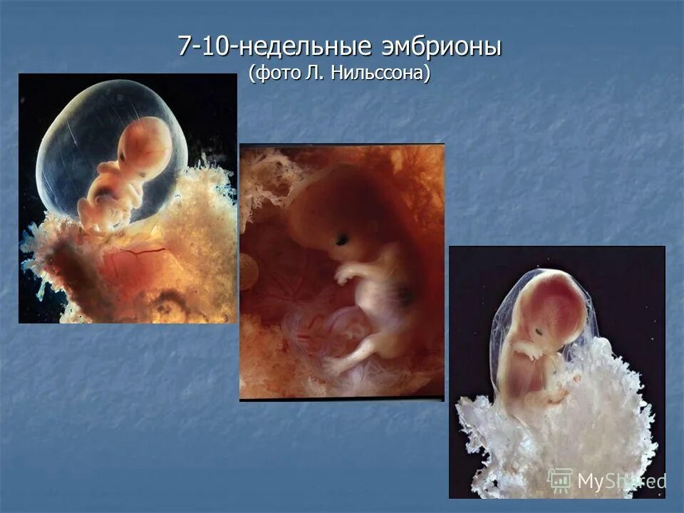 Эмбрион человека 4-6 недель. Человеческий эмбрион на ранних этапах. Про 6 неделю