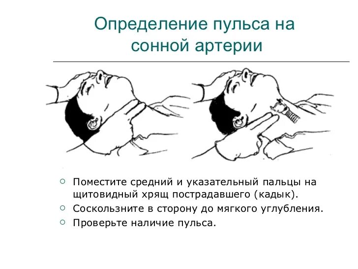 Определение пульса на сонной артерии. Как измерить пульс на сонной артерии. Определение пульсации на сонной артерии. Определение пульса у пострадавшего. Сонная артерия как нащупать где