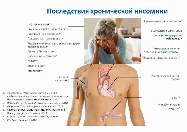 Синдром инсомнии. Хроническая ишемия головного мозга дифференциальный диагноз. дифференциальный диагноз опухоли головного мозга. подтипы хронической инсомнии. терапевтические диагнозы список.