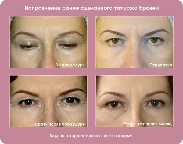 Можно после татуажа идти в баню
