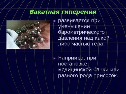 Гиперимия это
