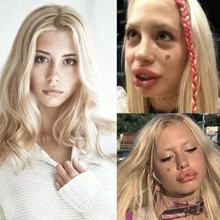 Девушка пластика