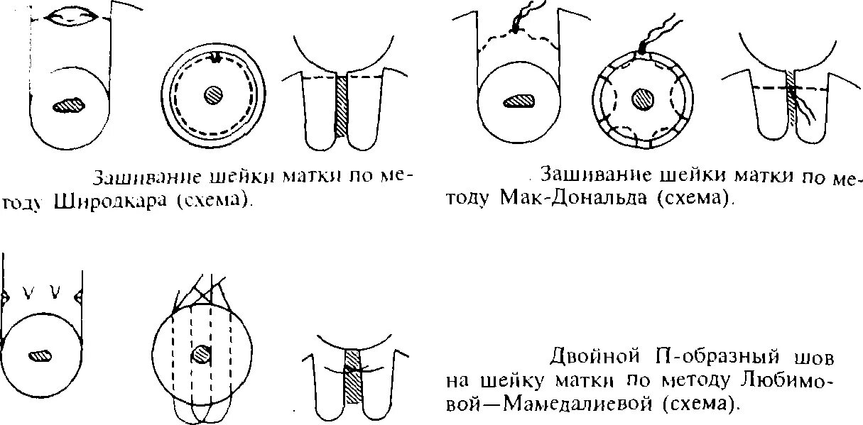 Картинки беременных. Котики и беременные женщины. Заштопанная ткань. Можно ли беременным зашивать. Пирсинг пупка беременной.