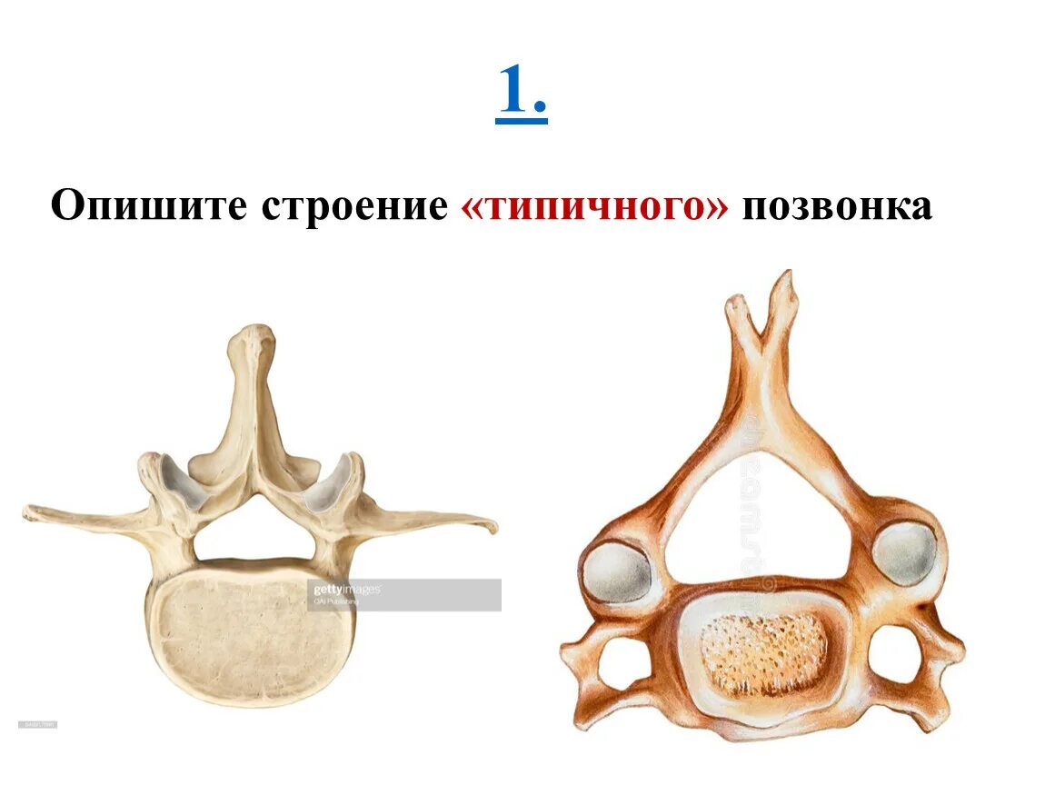 Строение типичного позвонка. Типичный шейный позвонок. Опишите строение позвонка. Типичный позвонок анатомия. Характерные признаки шейного позвонка