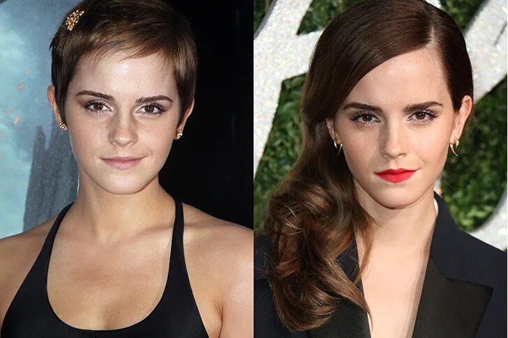 эмма уотсон цвет волос. длинные или короткие волосы. какие волосы лучше длинные или короткие. длинные или короткие волосы. эмма уотсон до и после пластики.