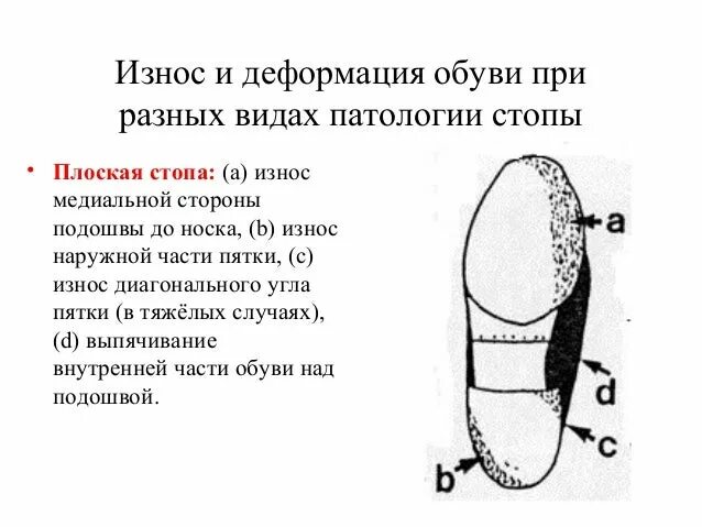 Определение подошва. Износ обуви при плоскостопии. Части подошвы. Части подошвы обуви. Изношенные подошвы обуви.