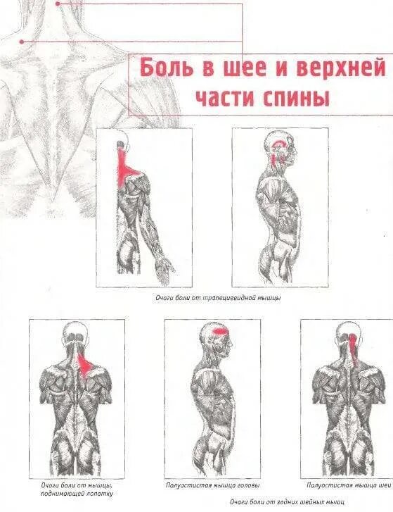 Отдает в левую сторону спины. Боль в нижней части шеи сзади и в плечах. болит мышца на шее с левой стороны сзади. болит ниже шеи сзади справа. болит верхняя часть спины и шея.