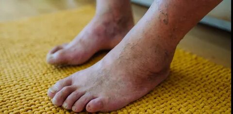 Ayol qogirchoq bilan jinsiy aloqa