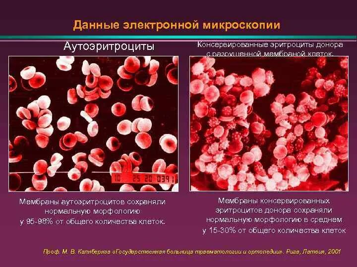 Где происходит разрушение эритроцитов