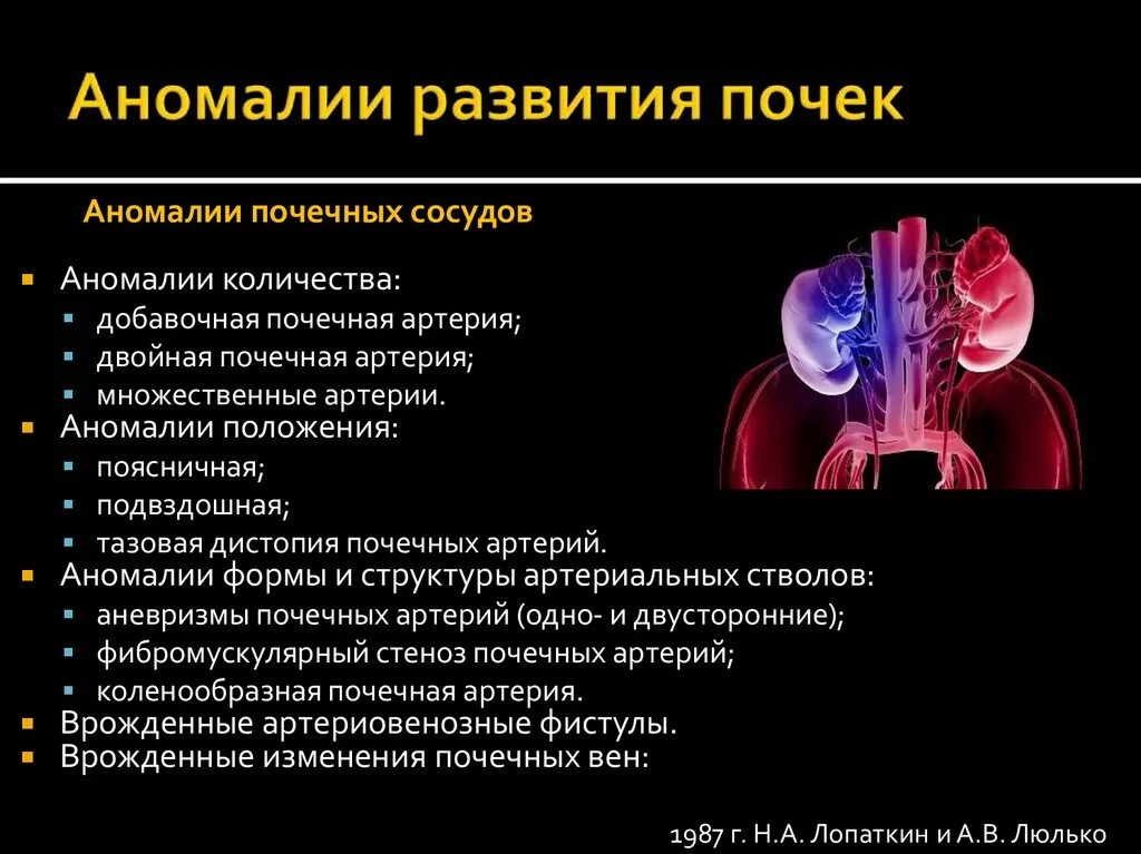 Аномалии развития мочеполовой. Аномалии развития почек и верхних мочевых путей. Врожденные пороки развития почек диагностика. Пороки развития верхних мочевых путей классификация. Аномалии развития почек дистопия.