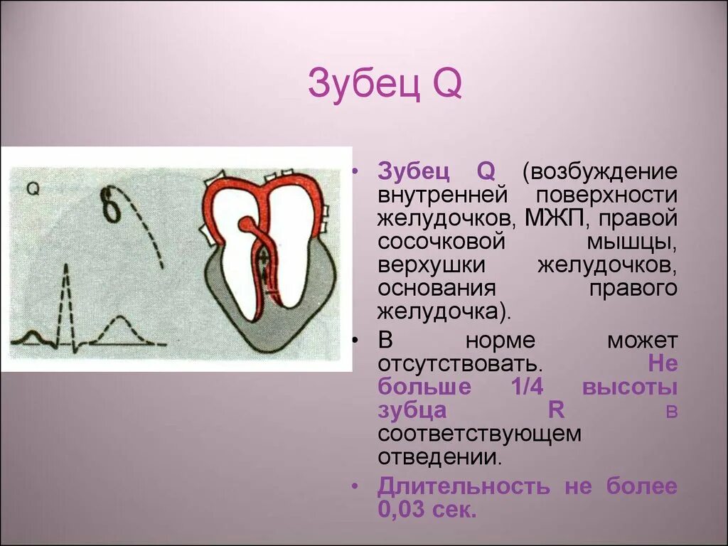 Изменение зубца q. Зубец q > 1/3 зубца r. Зубец q на ЭКГ В норме. Формирование патологического зубца q. Патологический зубец q на ЭКГ.