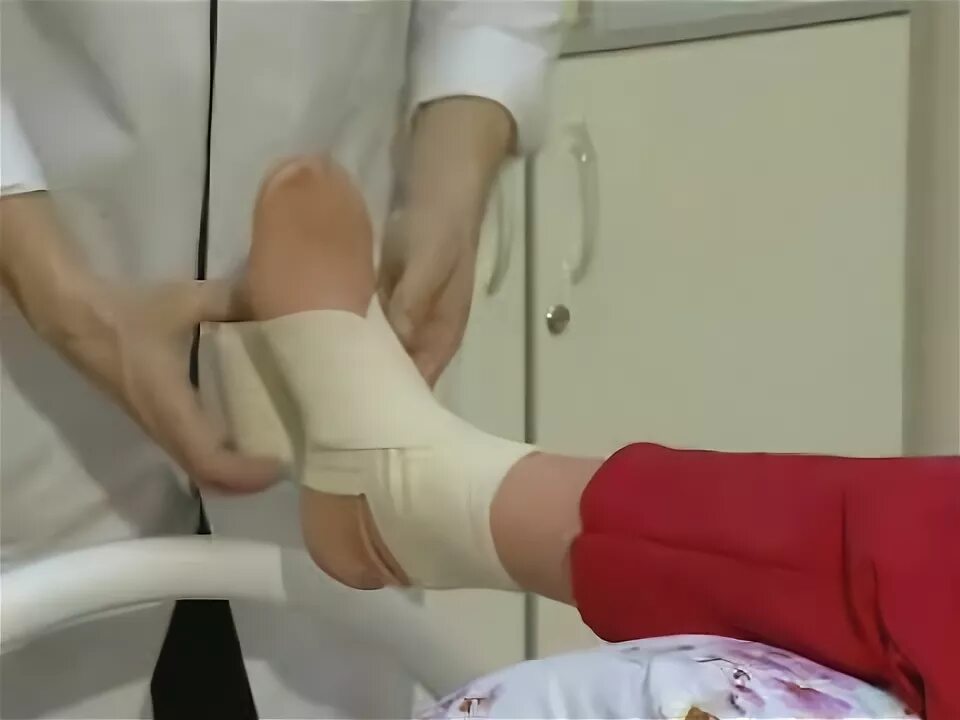 Бинты после эндопротезирования. Забинтованное колено после операции. Эластичный бинт после операции на тазобедренном суставе. Бинтование ног эластичным бинтом после операции эндопротезирования. Бинт при варикозе.