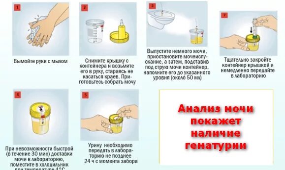 Перед сдачей анализа мочи нужно. Сбор мочи на сахар памятка. Анализ мочи. Порция мочи для анализа. Средняя порция мочи для анализа.