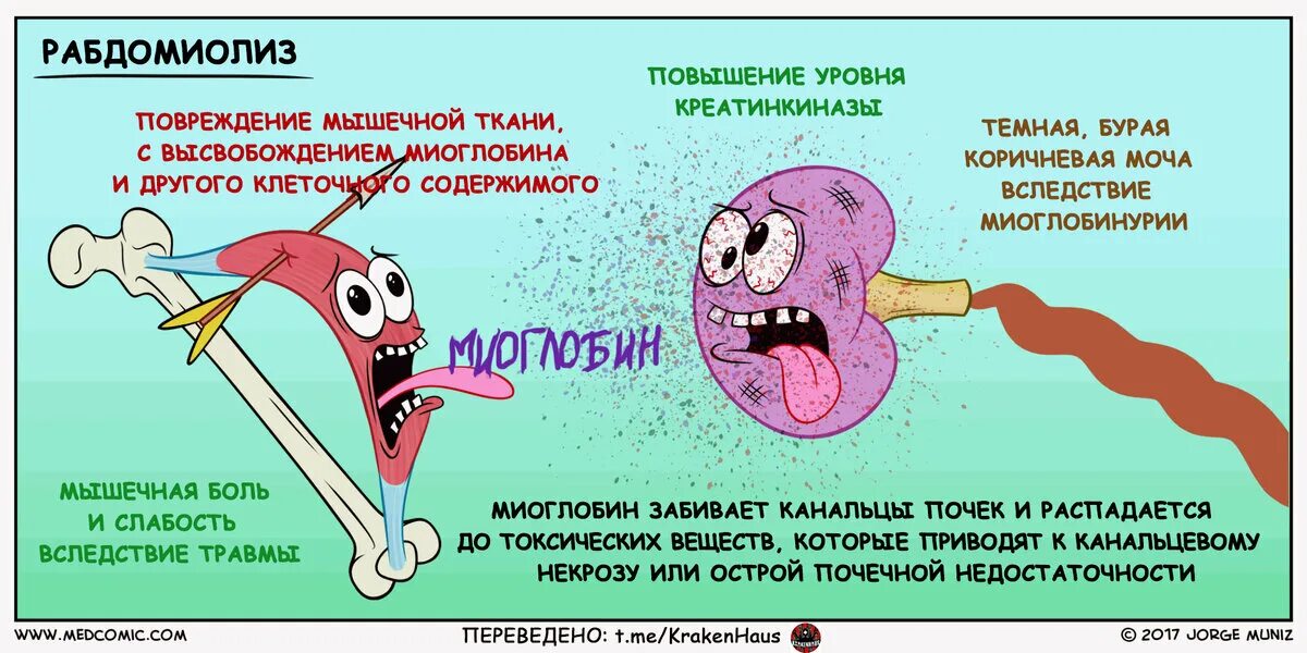 Ебеда что это. Рабдомиолиз. Рабдомиолиз симптомы. Рабдомиолиз лекарства. Разрушение мышечной ткани.