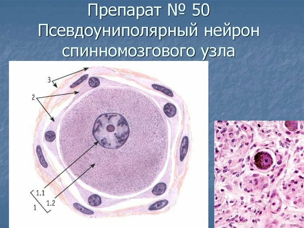 Сателлиты гистология. Клетки спинномозгового ганглия гистология. псевдоуниполярный нейрон в спинальном ганглии. псевдоуниполярные клетки спинального ганглия препарат. псевдоуниполярные нервные клетки спинномозговой узел гистология.