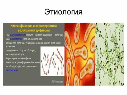 Дифтерия характеристика