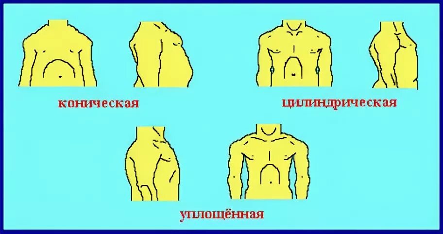 У спортсменов чаще наблюдается форма грудной клетки. У спортсменов чаще наблюдается форма грудной клетки