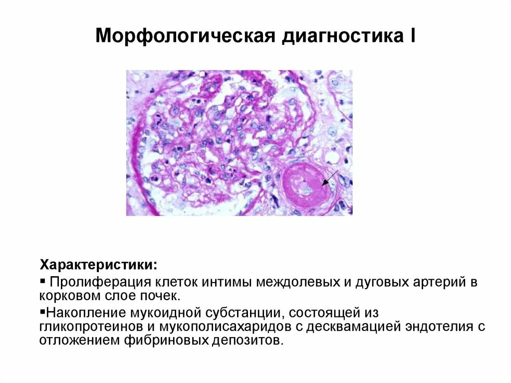 Морфологическая характеристика. Морфологический диагноз. Морфология диагноз. Морфологическая диагностика.