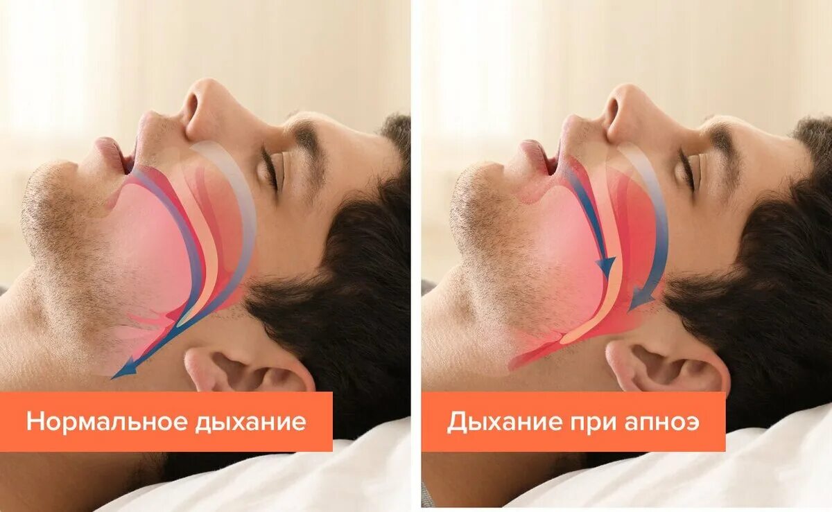 Нарушение сна. Женщина утром в постели. Девушка просыпается утром. Спокойного сна. Девушка проснулась.