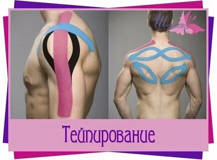 Тейпирование плеча