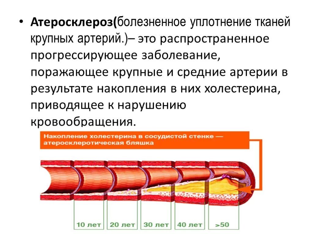 Признаки атеросклеротического поражения артерии. Атеросклероз венечных артерий стадии и степень. Атеросклеротического поражения стенок кровеносных сосудов. Атеросклеротическая болезнь коронарных артерий. Атеросклеротическое поражение сосудов.