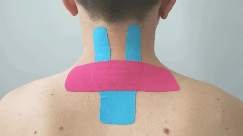 Тейпирование вдовьего горбика. Тейпы от сколиоза. Тейп на холку. Тейпы на холку. Тейпирование шея воротниковая зона.
