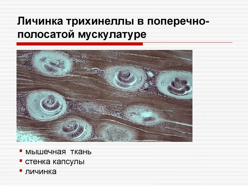 Личинки трихинеллы. Инкапсулированные личинки трихинеллы (Trichinella spiralis). Инкапсулированная личинка трихинеллы строение. Инкапсулированные личинки трихинеллы в мышцах препарат. Личинка трихинеллы инкапсулированная в мышечном волокне.