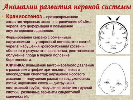 Аномалии развития нерва