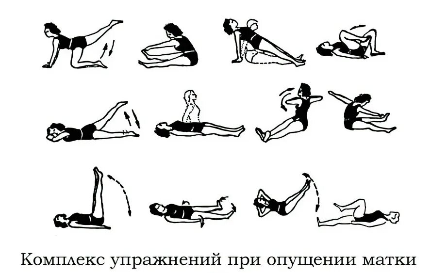 Почему опускается матка. Гимнастика кегеля для женщин для укрепления мышц. Зарядка кегеля для женщин для укрепления мышц матки. Упражнение кегеля для женщин для укрепления мышц влагалища. Комплекс упражнения при опущении органов малого таза 2 степени.