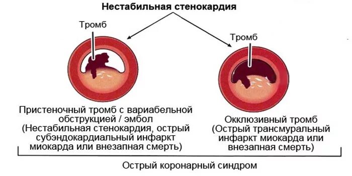 Нестабильные парни. Нестабильные парни. Нестабильные парни. Нестабильные парни. Нестабильные парни.